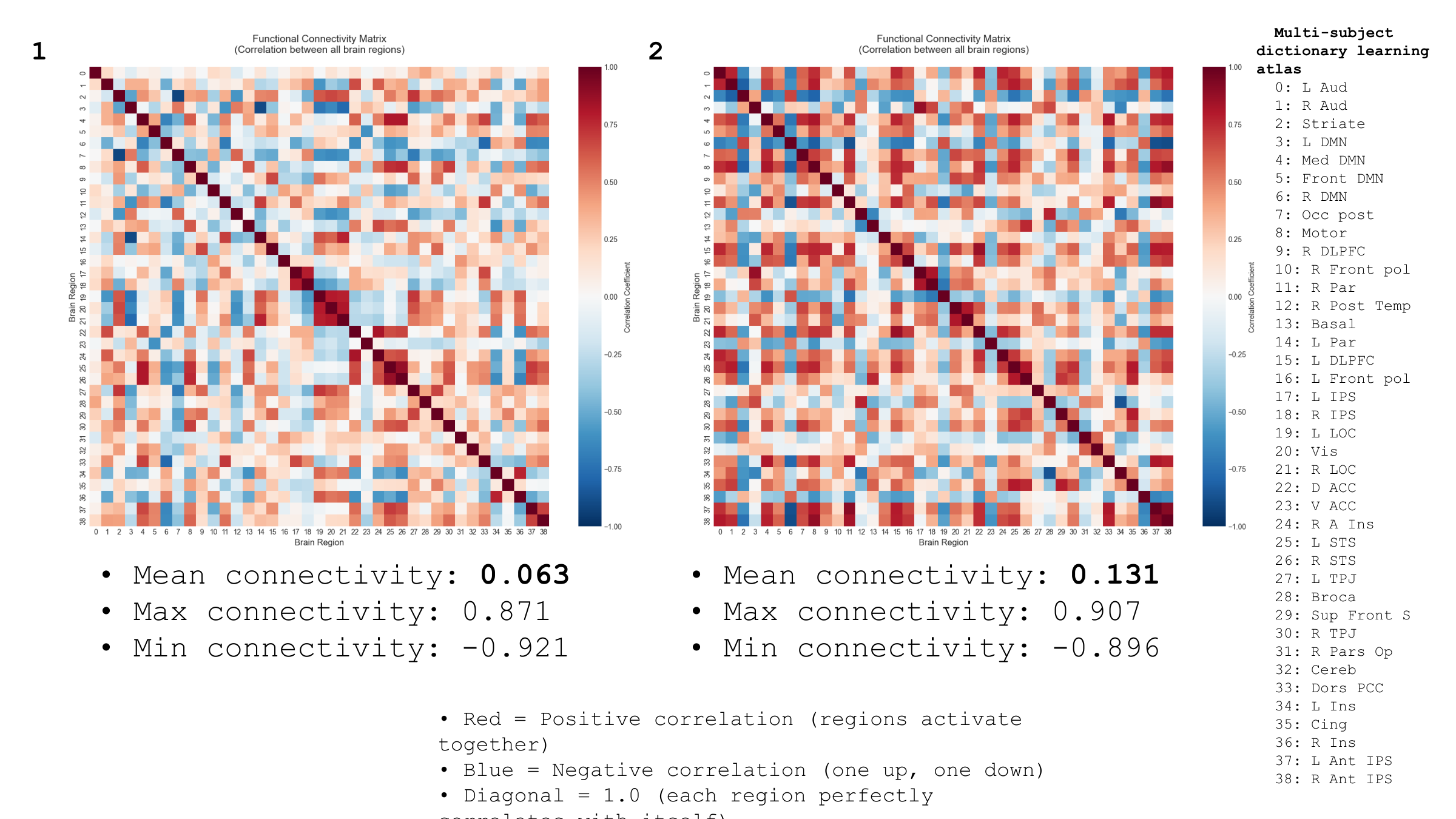 6-Week Whole-Brain Functional Connectivity Matrix Before and After tPBM — KYS, +107.9%