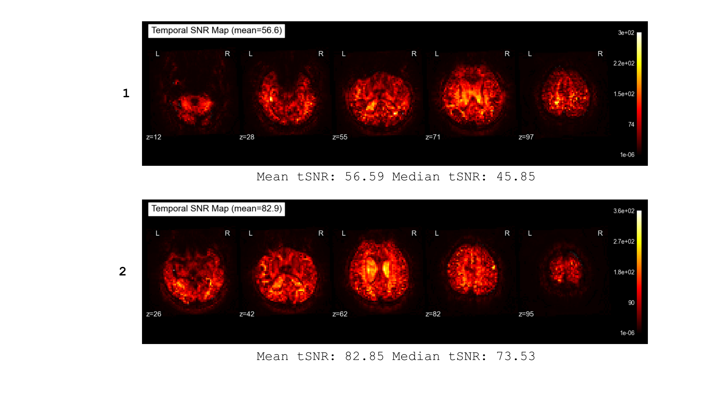 Temporal SNR Brain Heat Map Before and After tPBM — LJY, +46.4%